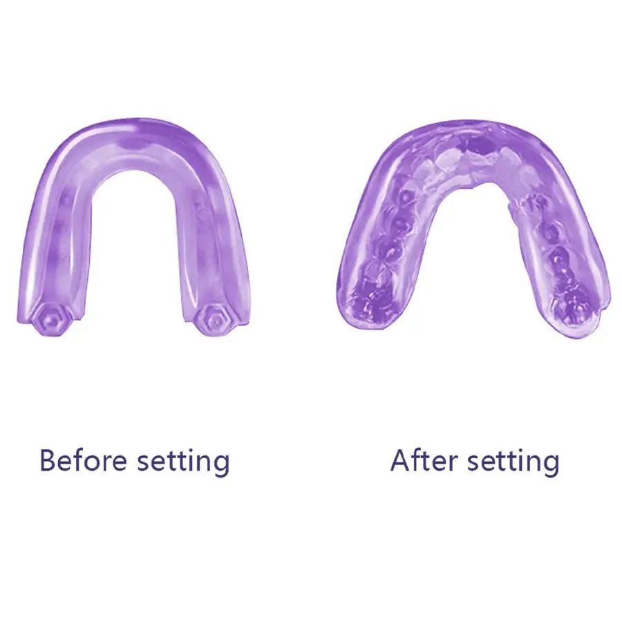 (Need to soak in hot water, heat and shape before use) Boxing braces, Sanda training, dental guards, dental braces, gift box - KC’s Way‼️🥊